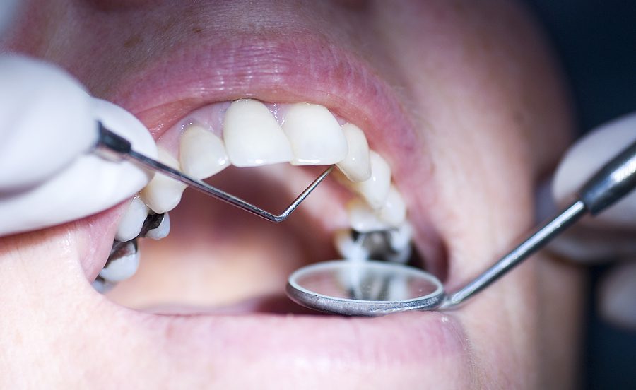 patient having a dental check up, close up with narrow depth of field 